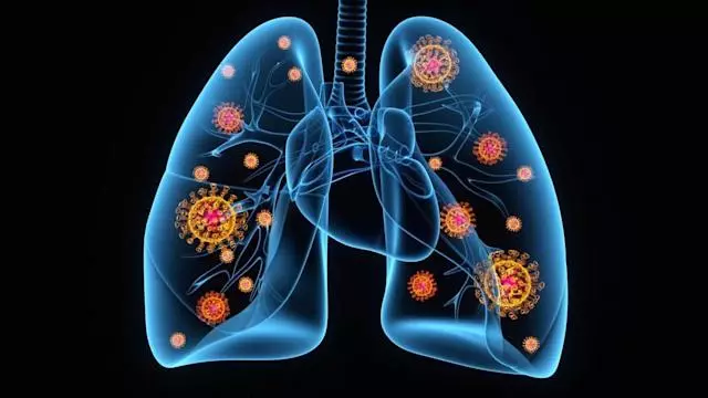 تمایز بین نشانه‌های سرماخوردگی، کرونا و بیماری‌های تنفسی: چگونه می‌توانید علائم را تشخیص دهید؟
