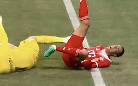 مصدومیت جمال موسیالا