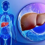 کبد چرب، قاتل خاموش بدن: چرا باید آن را جدی بگیریم؟