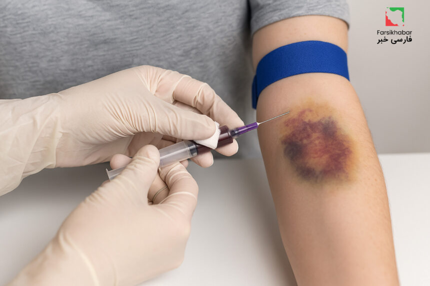 بیماری هموفیلی؛ چرا بیماران هنوز قربانی کمبود دارو هستند؟