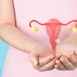 سندرم تخمدان پلی‌کیستیک؛ تقصیر ژنتیک است یا سبک زندگی مدرن؟