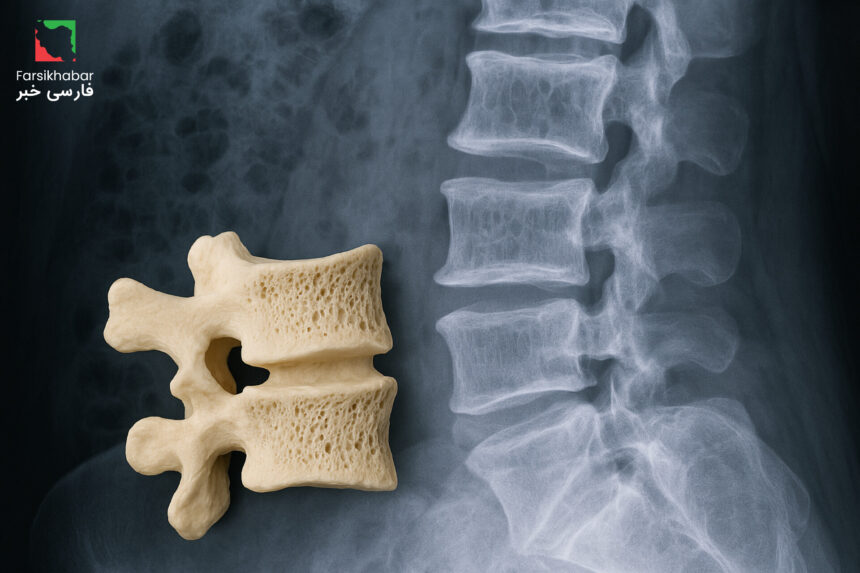 پوکی استخوان: علائم اولیه و روش‌های تشخیص زودهنگام
