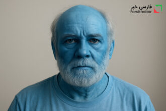 بیماری پوست آبی؛ معمایی نادر که بدن انسان را به رنگ آسمان درمی‌آورد