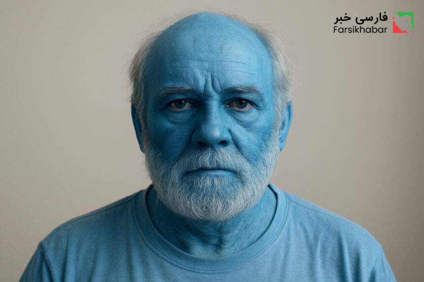 بیماری پوست آبی؛ معمایی نادر که بدن انسان را به رنگ آسمان درمی‌آورد