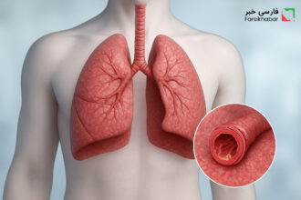 بیماری مزمن انسداد ریه: روش‌های پیشگیری و تغییر سبک زندگی