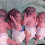 معجزه در زایش: نگاهی به غریب‌ترین نمونه‌های تولد چندقلویی در ایران و چالش‌های آن