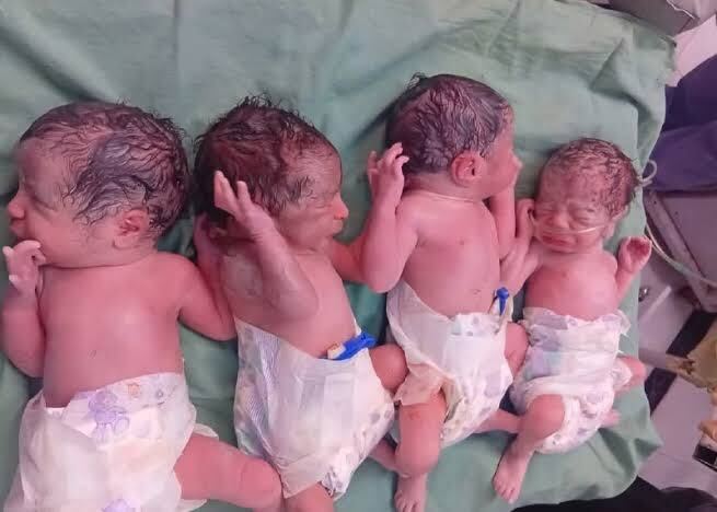 معجزه در زایش: نگاهی به غریب‌ترین نمونه‌های تولد چندقلویی در ایران و چالش‌های آن