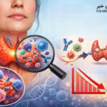 بیماری تیروئید هاشیموتو؛ چالش خاموش سیستم ایمنی و اختلال تدریجی هورمون‌ها