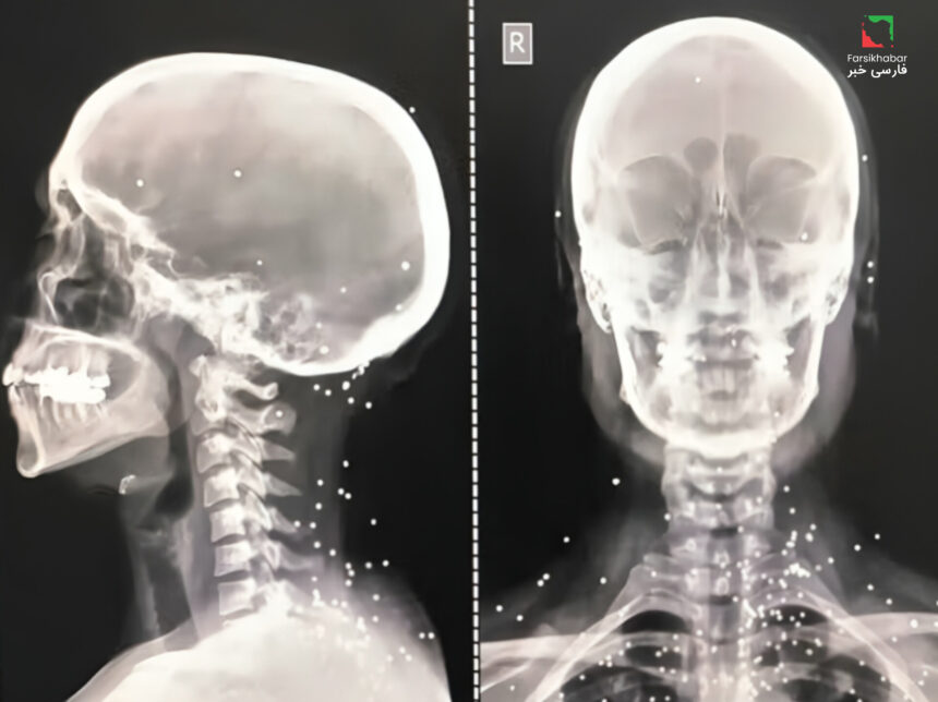 سرکوب خونین معترضان ایران؛ بررسی گسترده جراحات و پیامدها