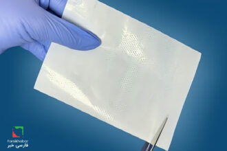 زخم‌پوش نانویی ایرانی؛ تحول در درمان پیشرفته زخم‌ها