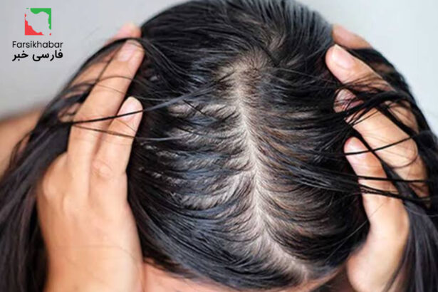 آیا کنترل چربی مو ضروری است یا یک باور اشتباه؟